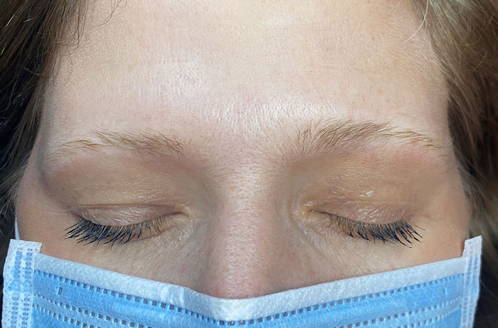 Before-Eyebrows-Microblad-Nancy-Akbari-www (2)