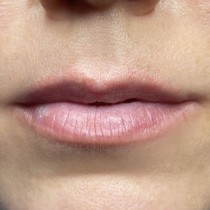 Before-Lip-Blush-www.cosmeticbybanou