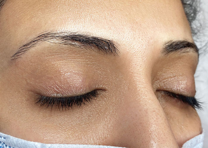 Before-Microblading-Eyebrow-by-Nancy-Akbari-www.cosmeticbybanou