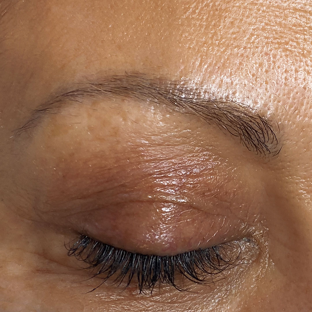 Before-and-After-Eyebrow-Microblading-Nancy-Akbari (1)