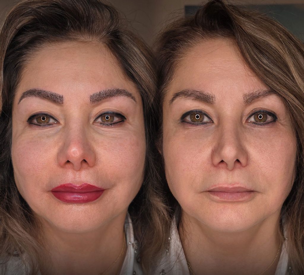 Complete Microblading and Full Lips Transformation Cosmeticbybanou