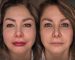 Complete Microblading and Full Lips Transformation Cosmeticbybanou