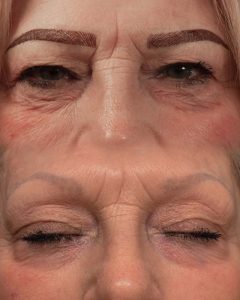 Microblading and Lip Blush Nancy Akbari Cosmeticbybanou