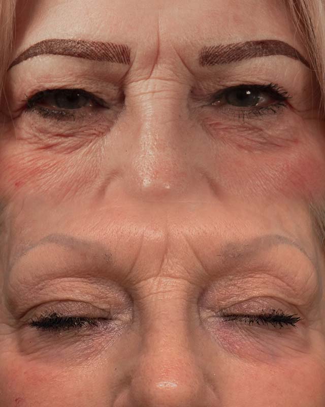 Microblading and Lip Blush Nancy Akbari Cosmeticbybanou