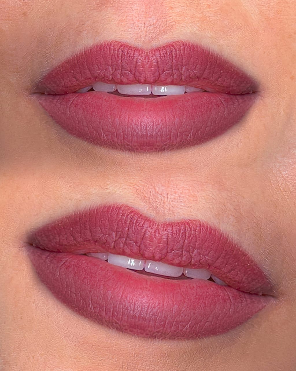 Dark Lip Neutralization with Natural Color Correction by Nancy Akbari Cosmeticbyabnou