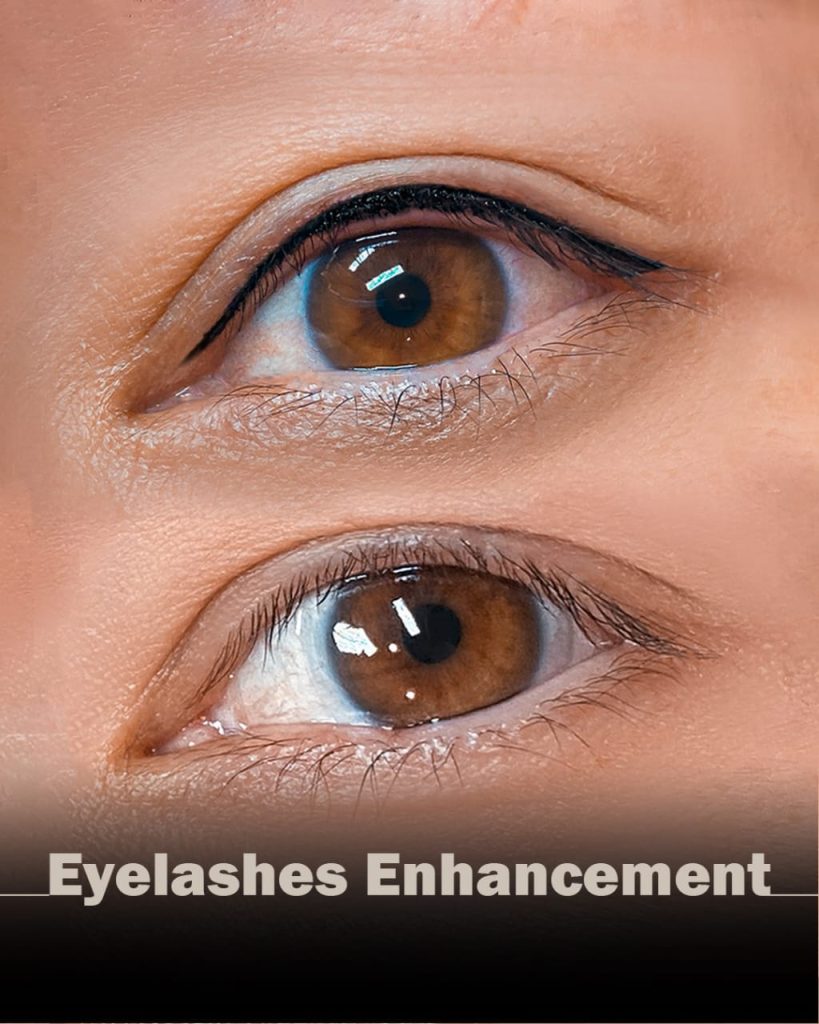 Natural Lash Enhancement by Nancy Akbari Cosmeticbybanou