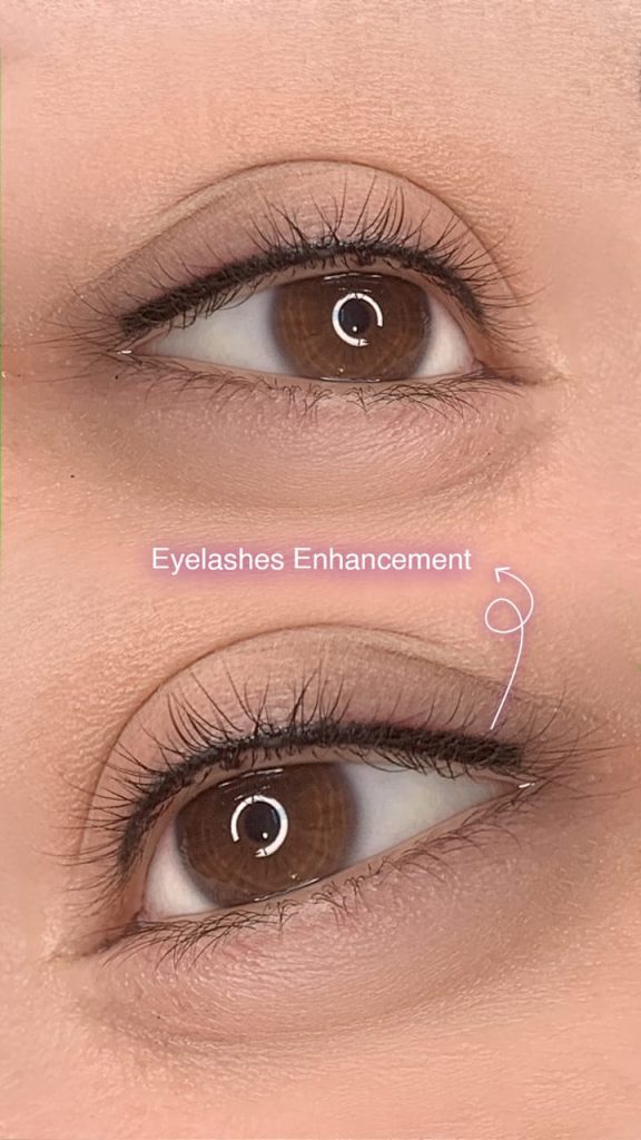Eyelash Line Enhancement by Nancy Akbari Cosmeticbybanou