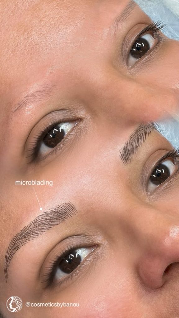 Best Microblading Brow Transformation by Nancy Akbari Cosmeticbybanou