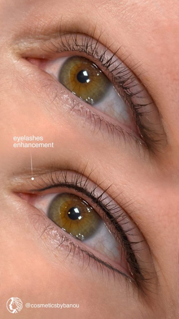 Eyelash Enhancement Transformation by Nancy Akbari Cosmeticbybanou