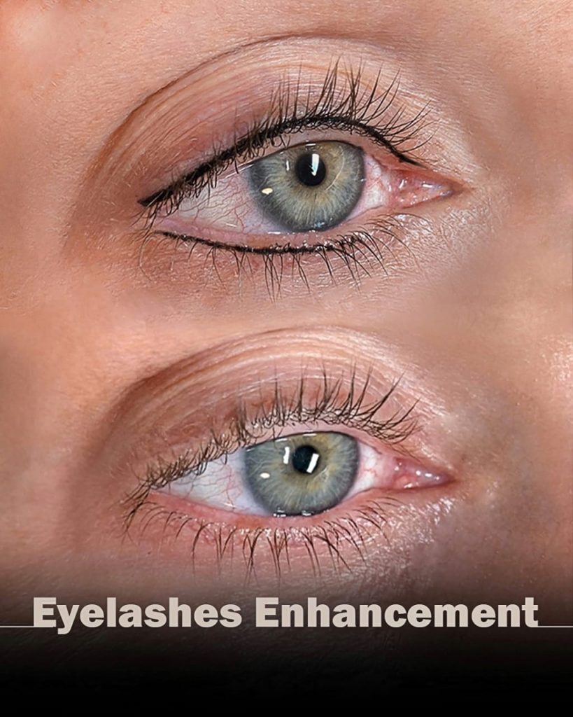 Eyelash Line Enhancement by Nancy Akbari Cosmeticbybanou