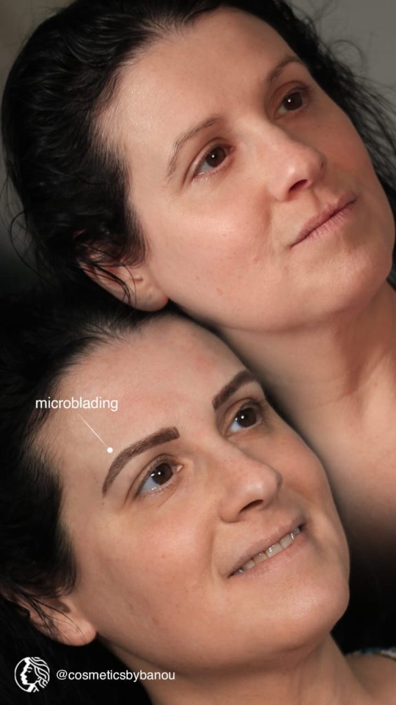 Microblading Brow Before and After by Nancy Akbari Cosmeticbybanou