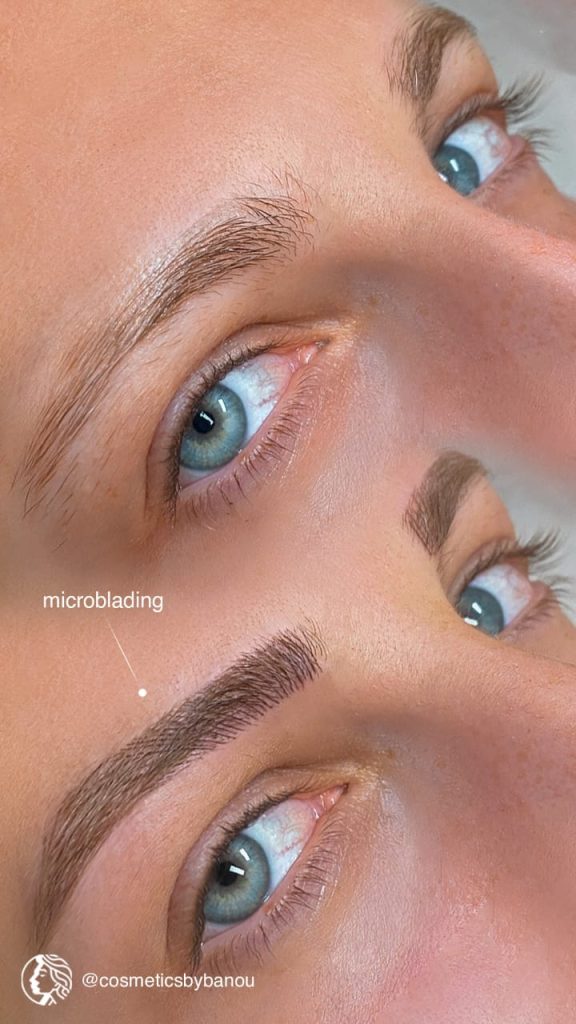 Microblading Brow Before and After by Nancy Akbari Cosmeticbybanou
