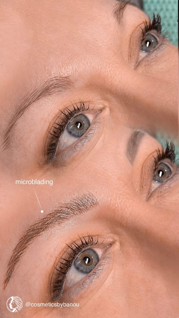 Microblading Brow Results by Nancy Akbari Cosmeticbybanou