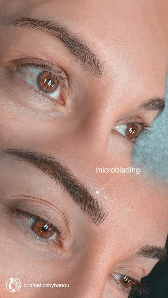 Microblading eyebrow in Beverly Hills by Nancy Akbari Cosmeticbybanou