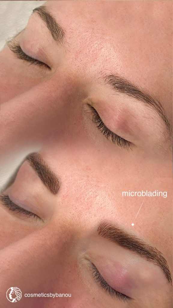 Natural Brows Microblading by Nancy Akbari Cosmeticbybanou