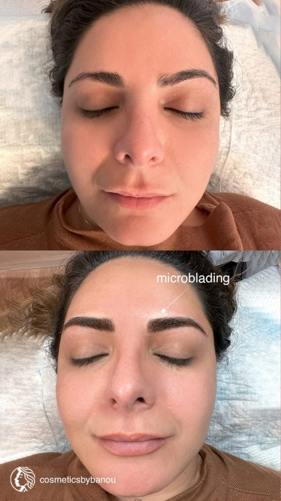 Natural Microblading Brow Transformation by Nancy Akbari Cosmeticbybanou