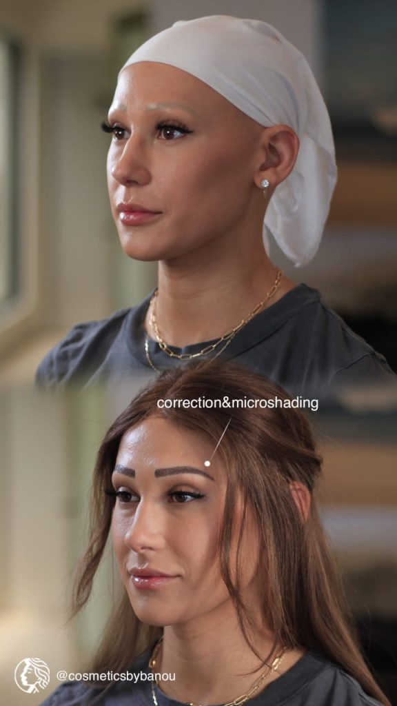 Eyebrow Correction and Microshading for Women with Hair Loss by Nancy Akbari Cosmeticbybanou