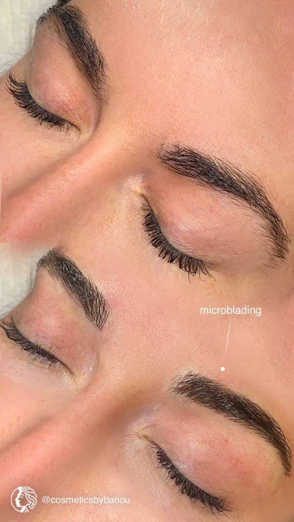 Natural Microblading Transformation by Nancy Akbari Cosmeticbybanou