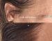 Natural Scalp Pigmentation by Nancy Akbari Beverly Hills Cosmeticbybanou