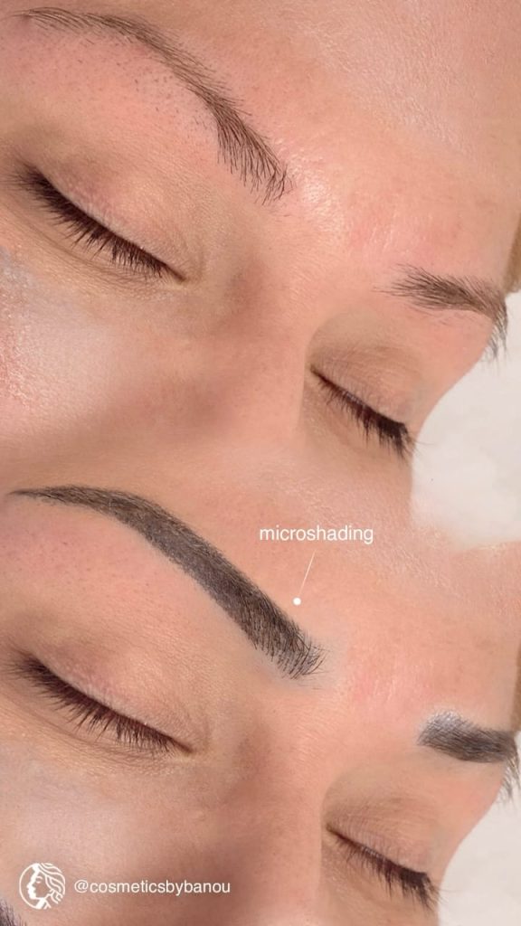 Soft and Defined Microshading Transformation by Nancy Akbari Cosmeticbybanou